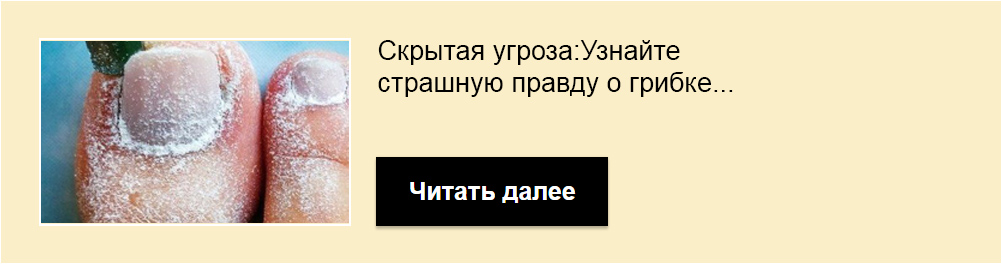 Календула от язвы желудка Календула от язвы желудка thumbnail